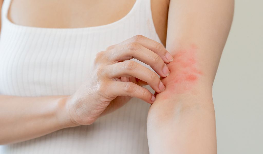 Woman itching irritated skin
